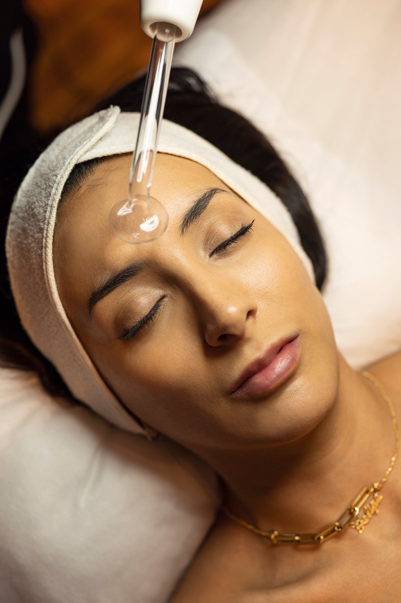 Tratamiento Especializado para Rosácea (4 sesiones)